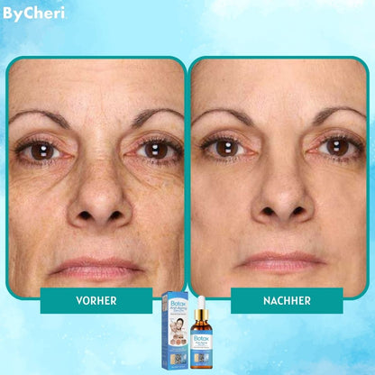 1+1 FREE | Botox Anti-Aging Serum™ Intensive Anti-wrinkle Treatment