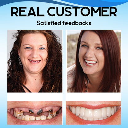 Silicone Reline Denture Set™ - Give your smile a new shine