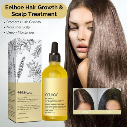 1+1 FREE | Eelhoe™ - Natural Hair Oil