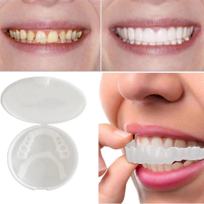 Snap-on Teeth™ - The Secret to a Hollywood Smile!