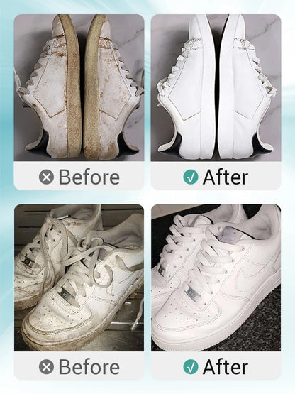 1+1 FREE | ShoeSaver™ Restore Your Shoes